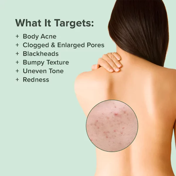 MEDix™ Back Acne Treatment Spray