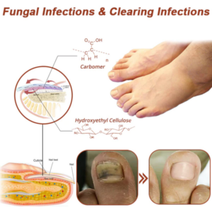 Efficiency Light Therapy Device For Toenail Diseases