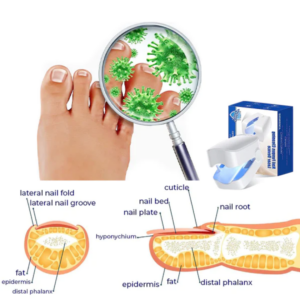 Efficiency Light Therapy Device For Toenail Diseases