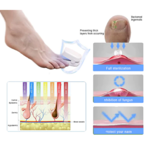 Efficiency Light Therapy Device For Toenail Diseases