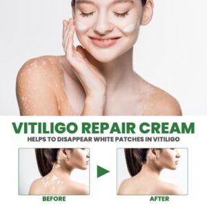 Oveallgo™ Vitiligo Fix Revitalize Elixir