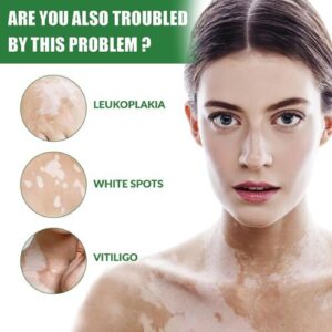 Oveallgo™ Vitiligo Fix Revitalize Elixir