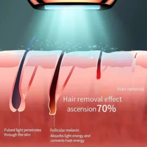 IPL Laser Hair Removal