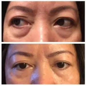 Eye Moisturizing Anti-aging EyeCream