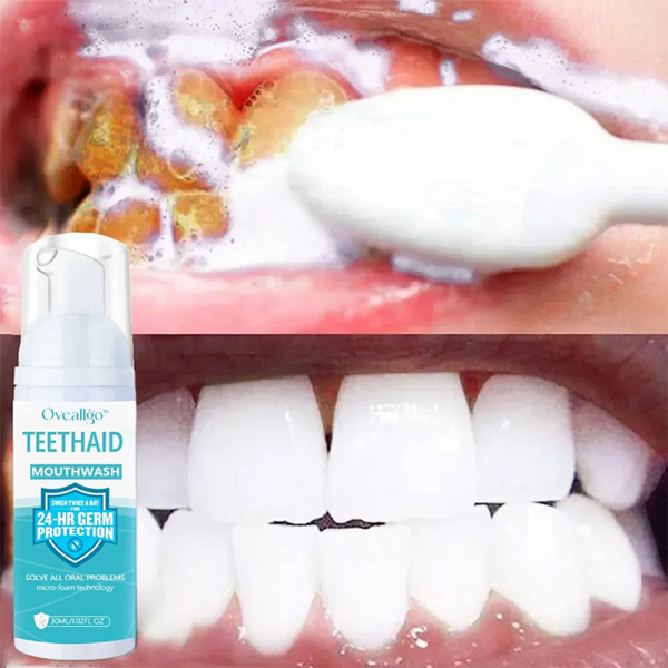 Oveallgo™ Intensive mousse for cleaning the oral cavity