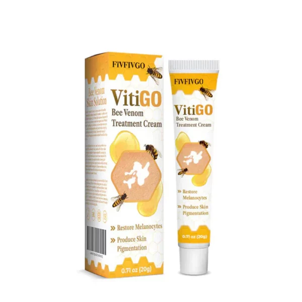 Vitiligo Treatment Cream