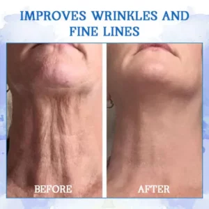 𝐅𝐮𝐛𝐬𝐭𝐚® Ultra Firming & Wrinkle-Reducing Cream