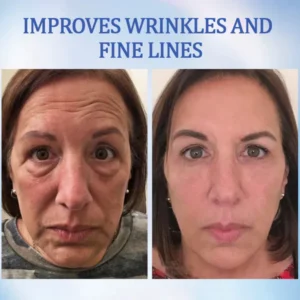 Fivfivgo™ Advanced Firming & Anti-Wrinkle Cream