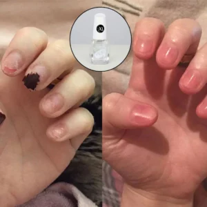 XL Nails - Growth Nail Polish