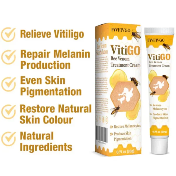 Vitiligo Treatment Cream