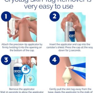 Cryotag Skin Tag Remover