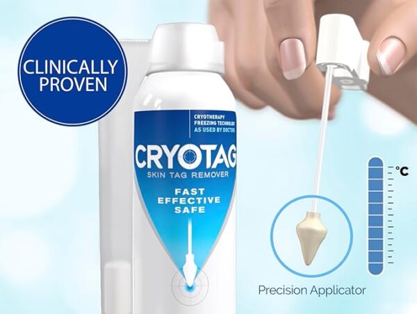 Cryotag Skin Tag Remover