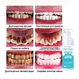 Oveallgo™ Intensive mousse for cleaning the oral cavity