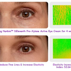 Nurbini™ DEleventh Pro-Xylane Active Eye Cream