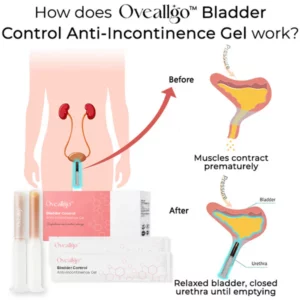 Oveallgo™ Bladder Control Anti-Incontinence Gel