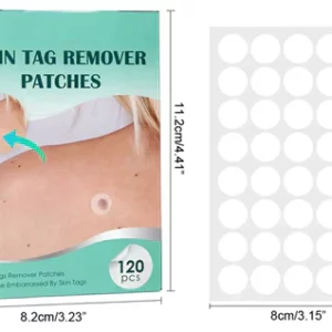 Skin Moles & Moles Removal Stickers