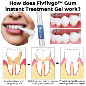 Fivfivgo™ Gum Instant-Behandlungsgel