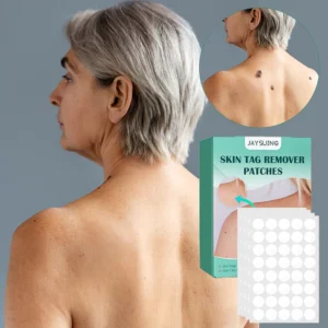 Skin Moles & Moles Removal Stickers