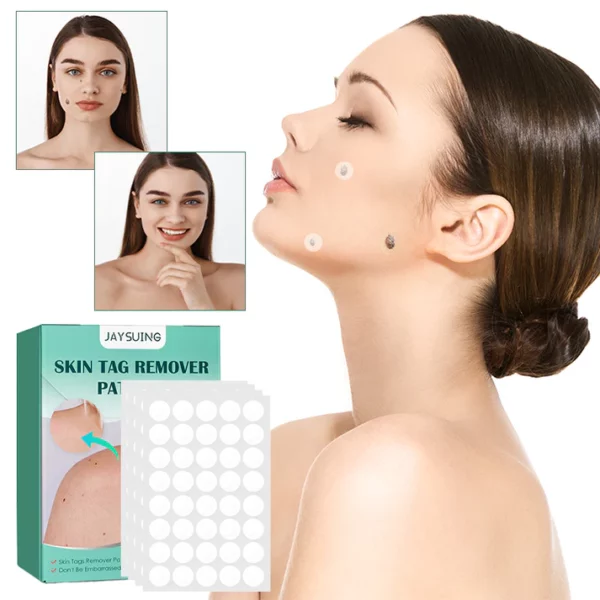 Skin Moles & Moles Removal Stickers