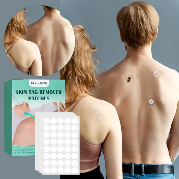 Skin Moles & Moles Removal Stickers