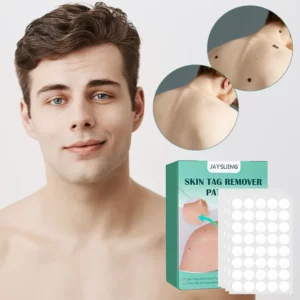 Skin Moles & Moles Removal Stickers