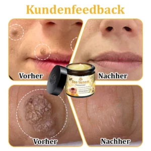 Turonu™ Bienengift Multitherapie-Creme