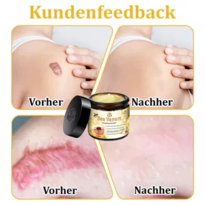 Turonu™ Bienengift Multitherapie-Creme