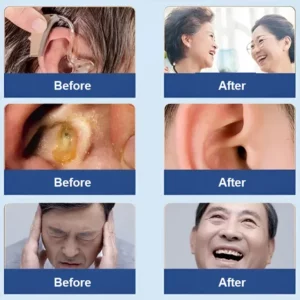 Gentle care to relieve tinnitus