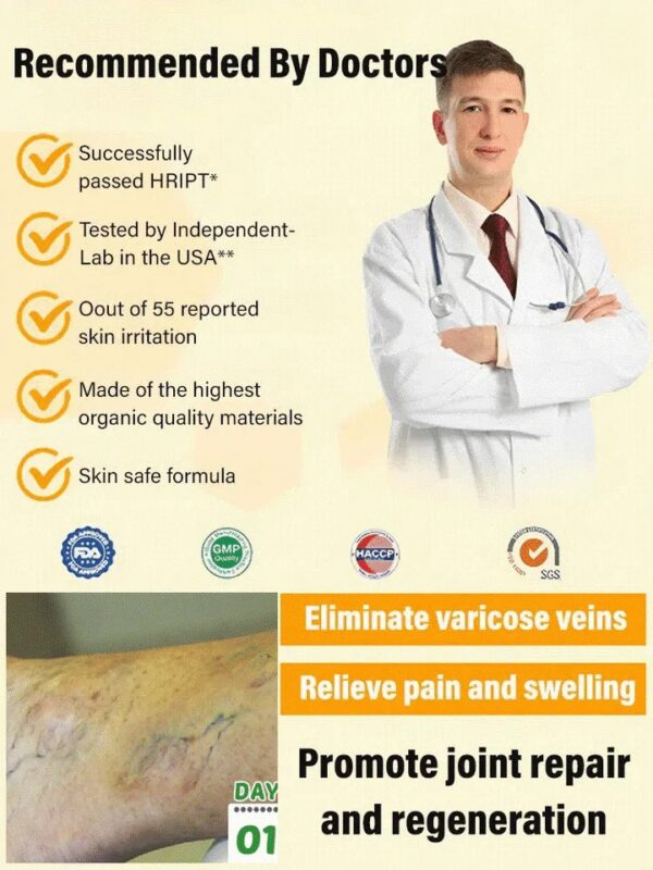 Varicose Vein Rapid Relief Cream