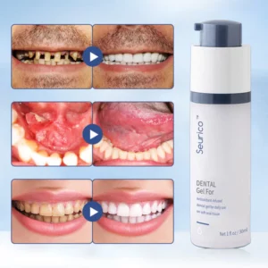 Seurico™ Teeth Whitening Repair Regrowth Dental Gel