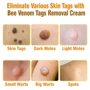 flysmus™ cream to remove bee venom tags