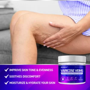 Seurico™ Varicose & Spider Veins Soothing Leg Cream