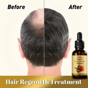 Seurico™ Organic hair growth oil blend