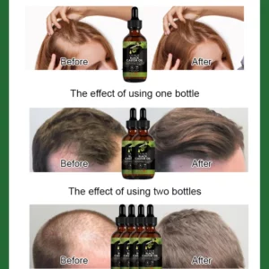 Castor Oil Dense Hair Growth and Repair Serum