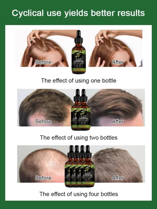 Castor Oil Dense Hair Growth and Repair Serum