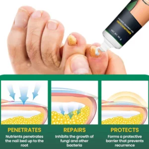 FLYCARE™ Nail Care Anti Fungal Cream