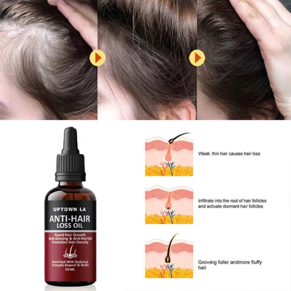 Uptown LA Anti Hair Loss Hair Regrowth Oil 30 ml