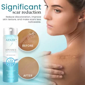 AEXZR™ Advance Scar Care Formula