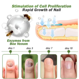 Nail serum with bee venom - growth and elimination of fungus in 10 days