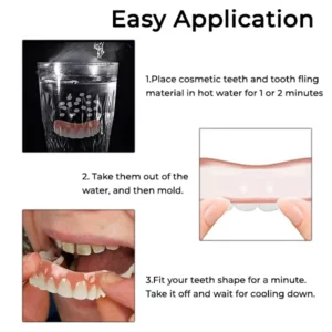 Oveallgo™ Comfort Soft Denture Relining Set