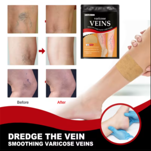 Varicose Veins Treatment Patches 12pcs