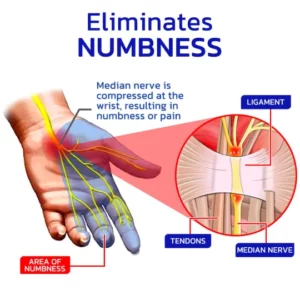 NumbFix Hands, Feet and Arthritis Spray