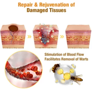 flysmus™ cream to remove bee venom tags