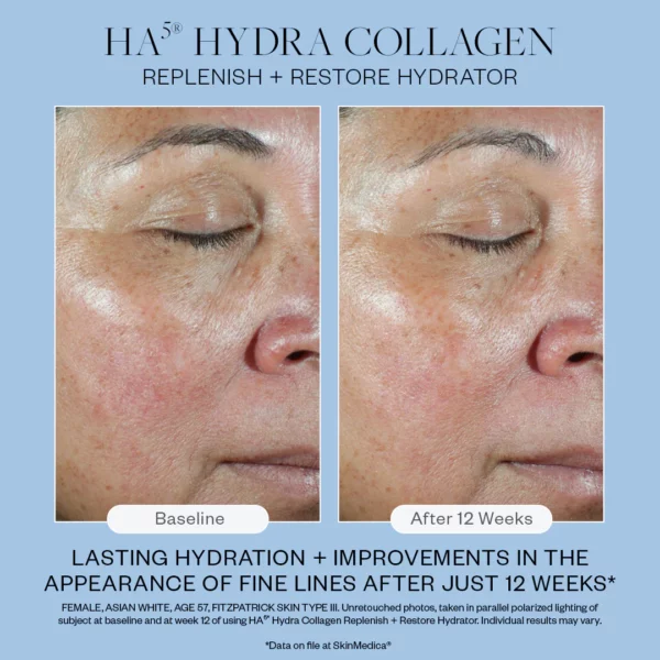 SkinMedica HA5 Hydra Collagen Replenish