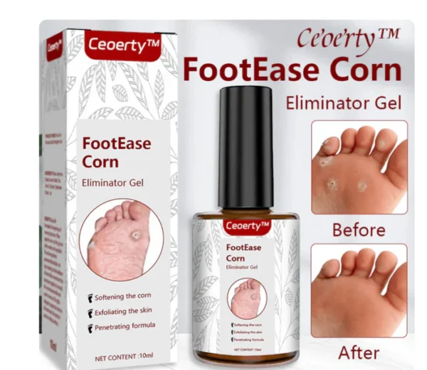 Original Footease Corn Eliminator Gel