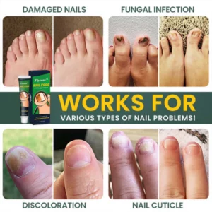 FLYCARE™ Nail Care Anti Fungal Cream