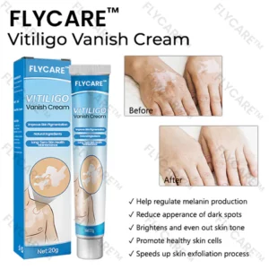 FLYCARE™ Vitiligo Vanish Cream