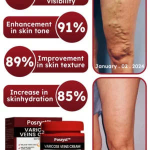 Varicose Vein Rapid Relief Cream