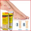 Tonis CREAM™ THE NEWLY DISCOVERED SOLUTION TO CLEAR ALL VARICOSE VEINS AND SPIDER VEINS!