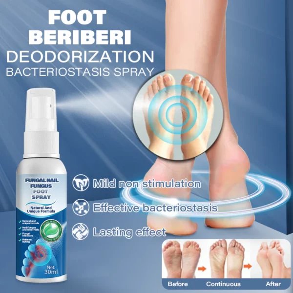 LOVILDS™ Medical Grade Nail Fungus Foot Strengthening Spray